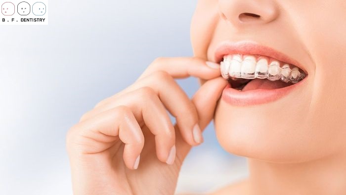 Vai trò của niềng răng chỉnh nha?