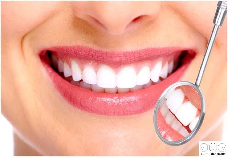 Chia sẻ cách điều trị răng thưa hiệu qủa nhất
